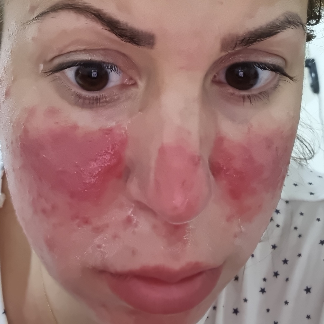 Formelskin Image