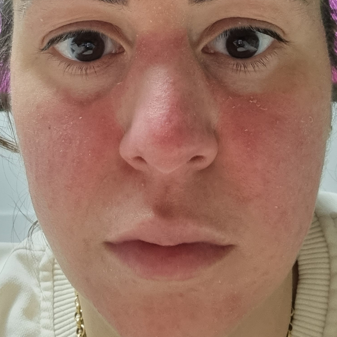 Formelskin Image