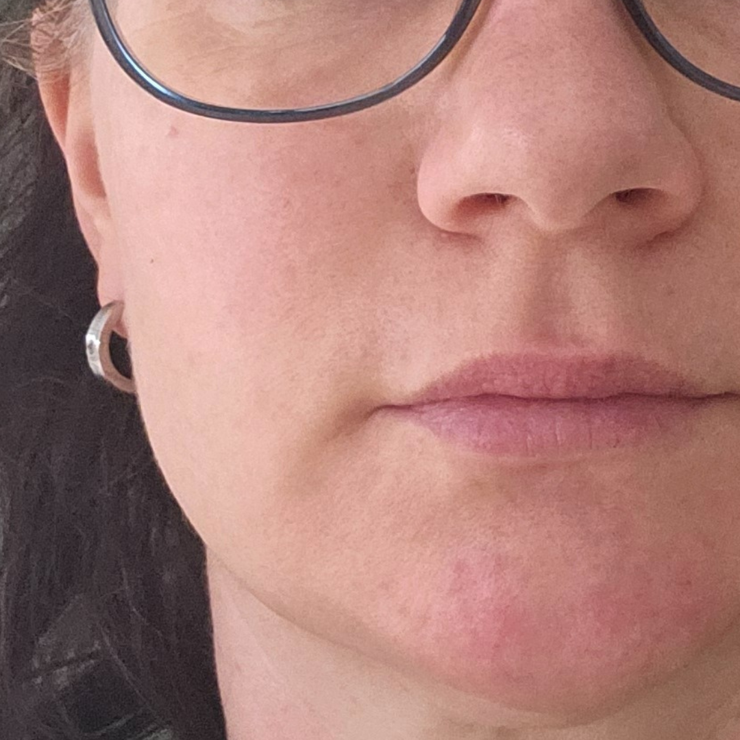 Formelskin Image