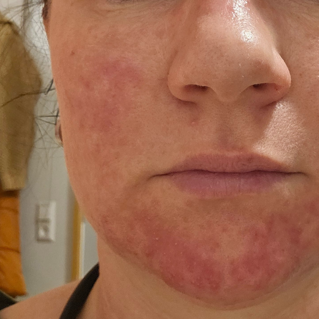 Formelskin Image