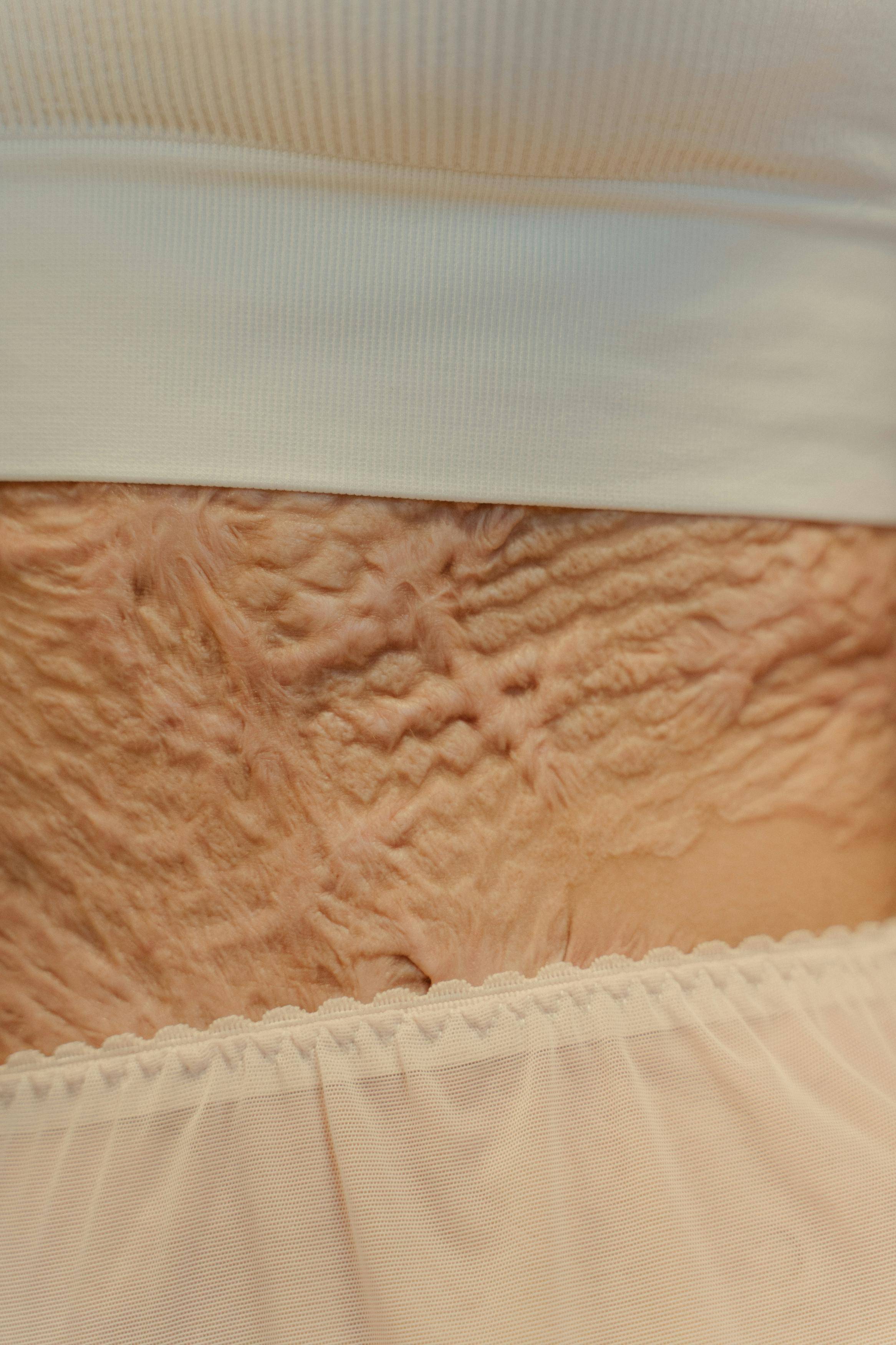 Formelskin Image