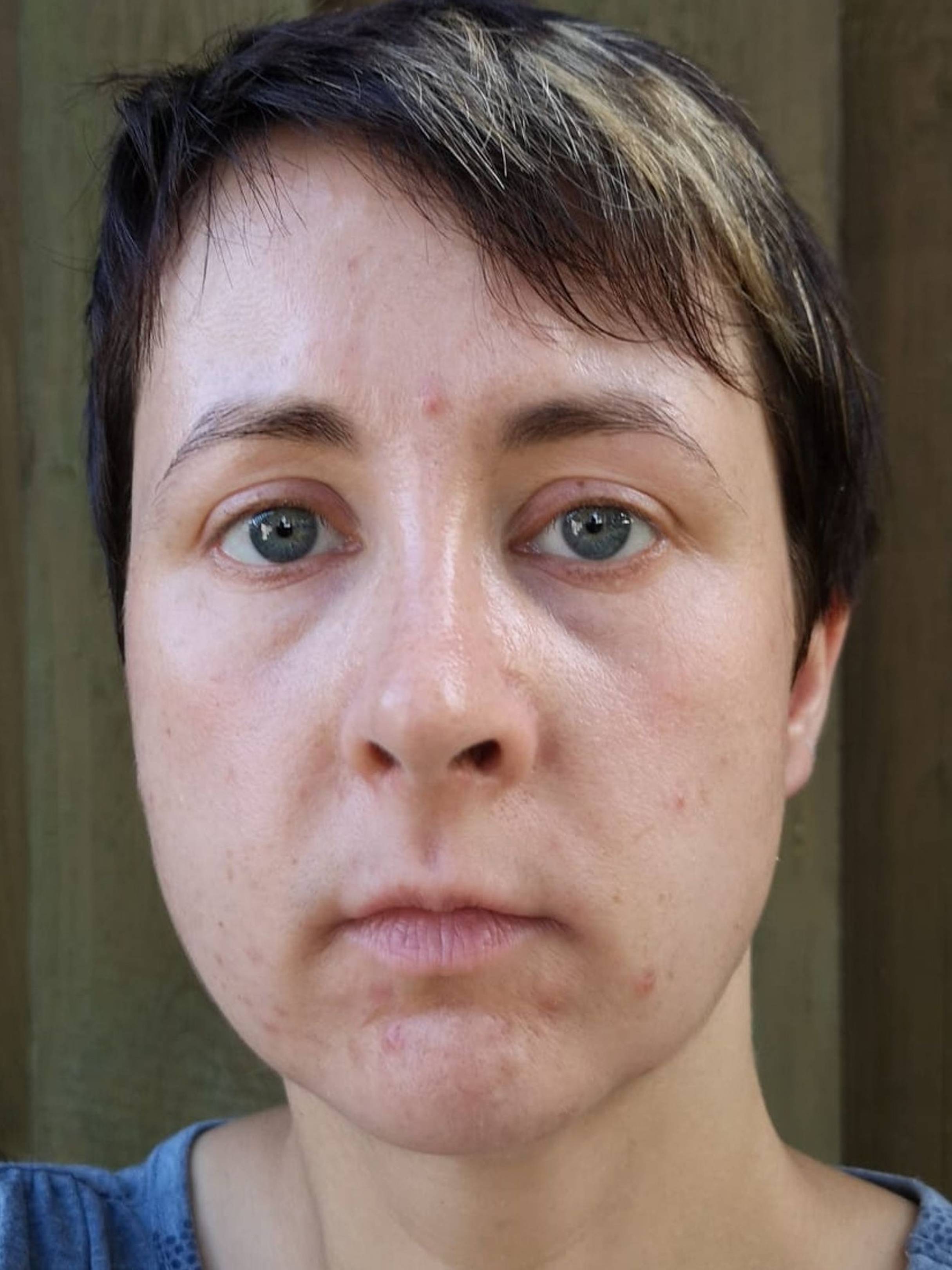 Formelskin Image