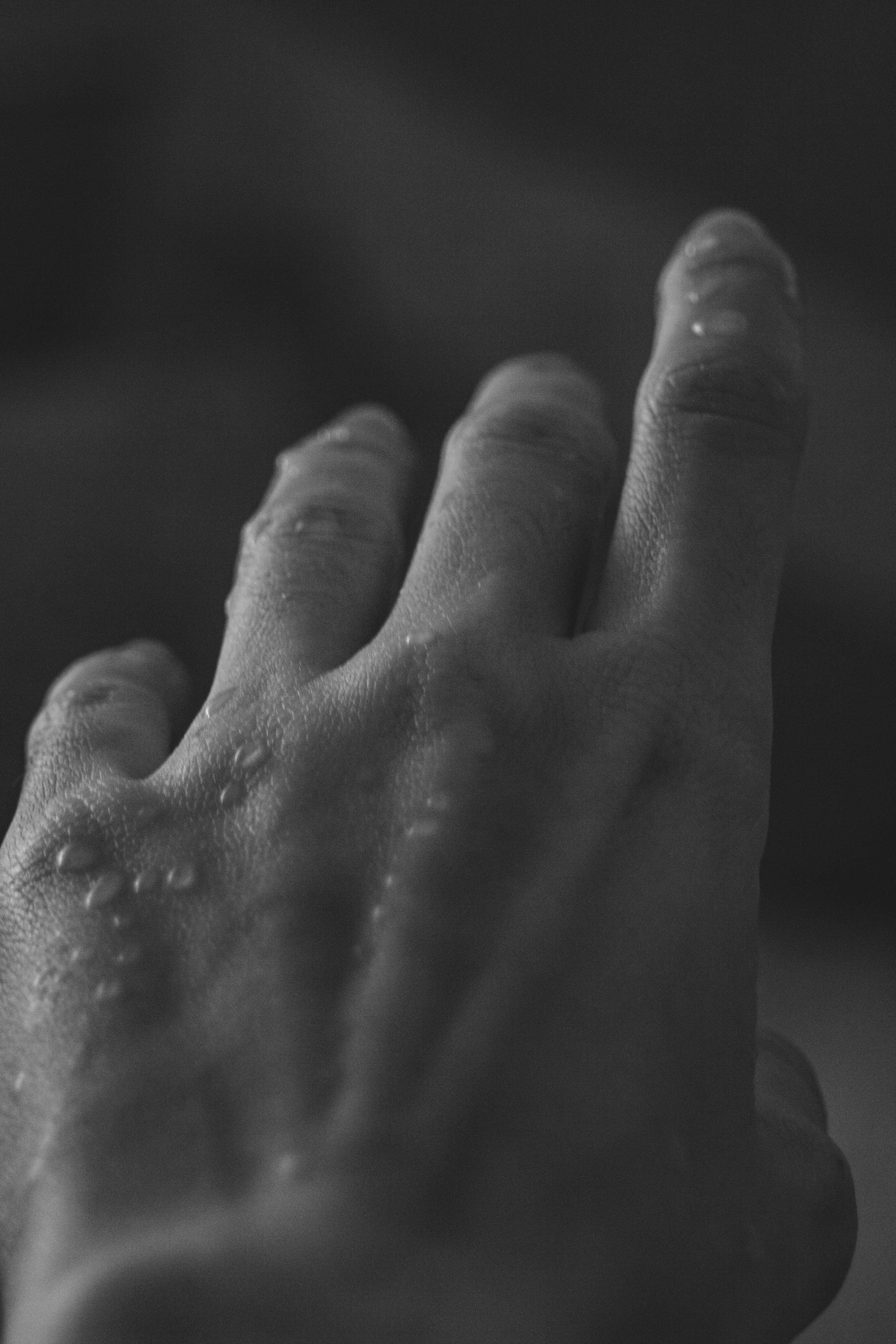 Formelskin Image