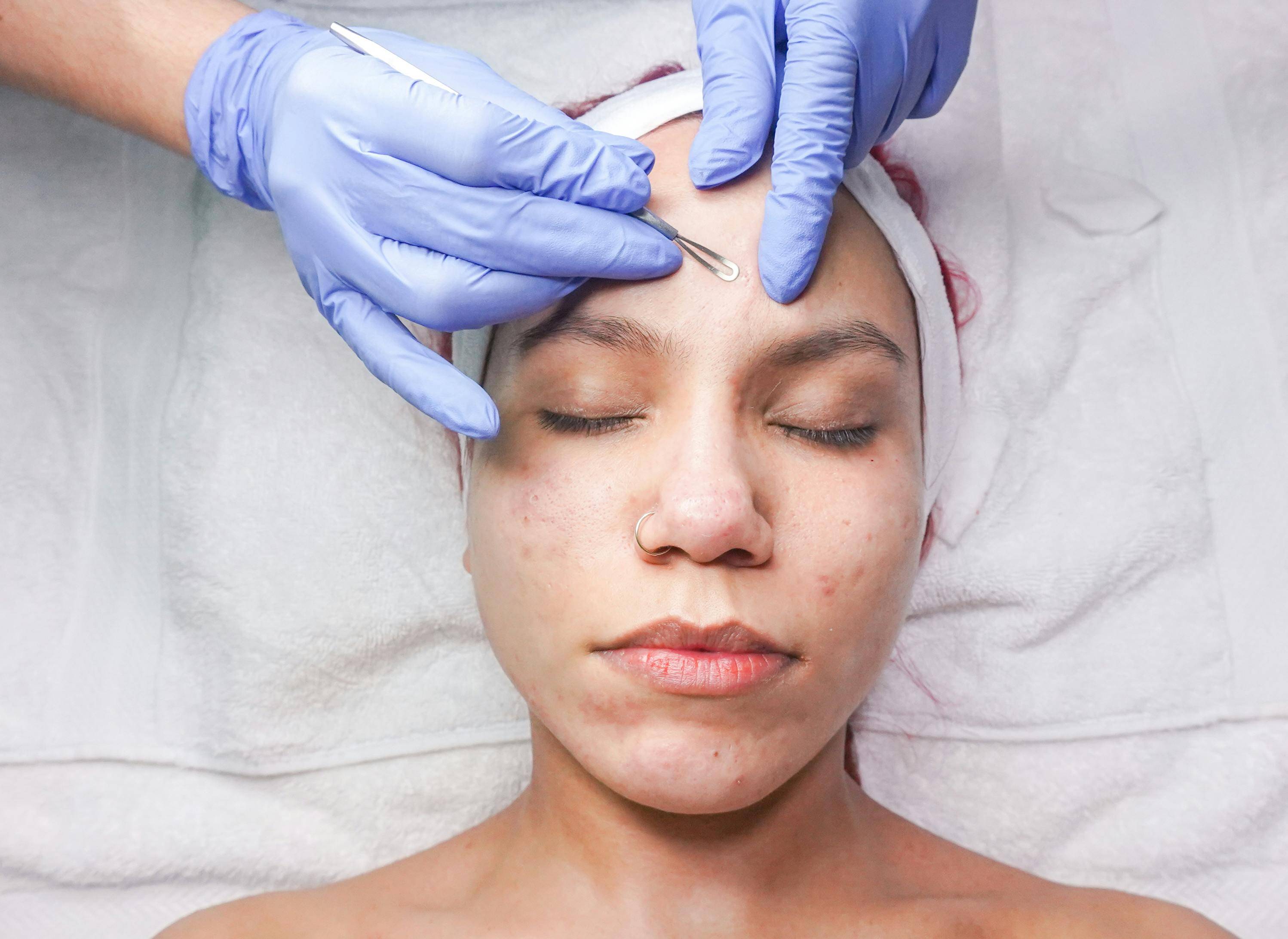 Formelskin Image