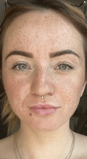 Formelskin Image