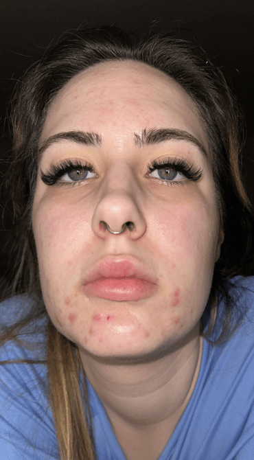 Formelskin Image