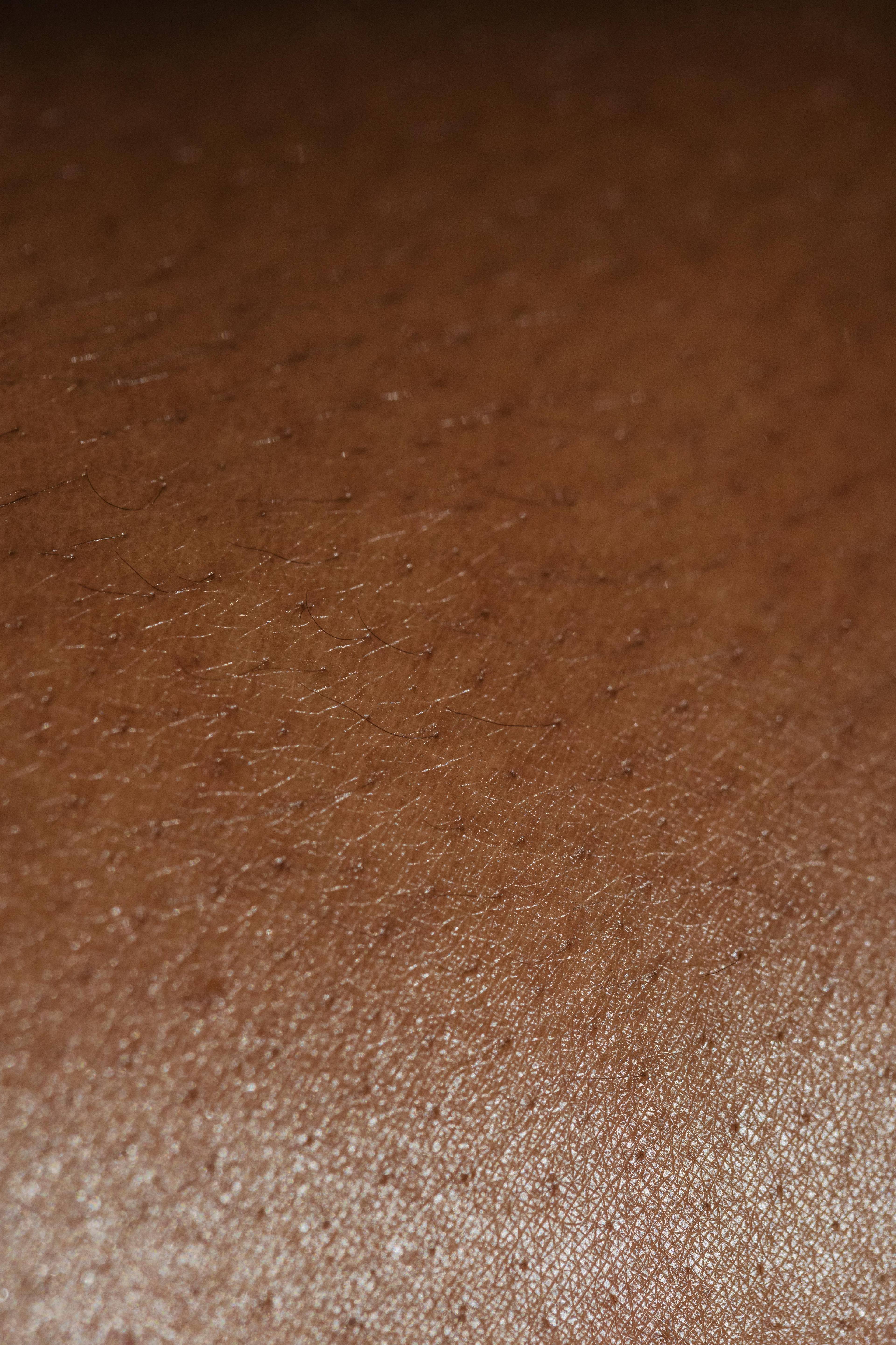 Formelskin Image
