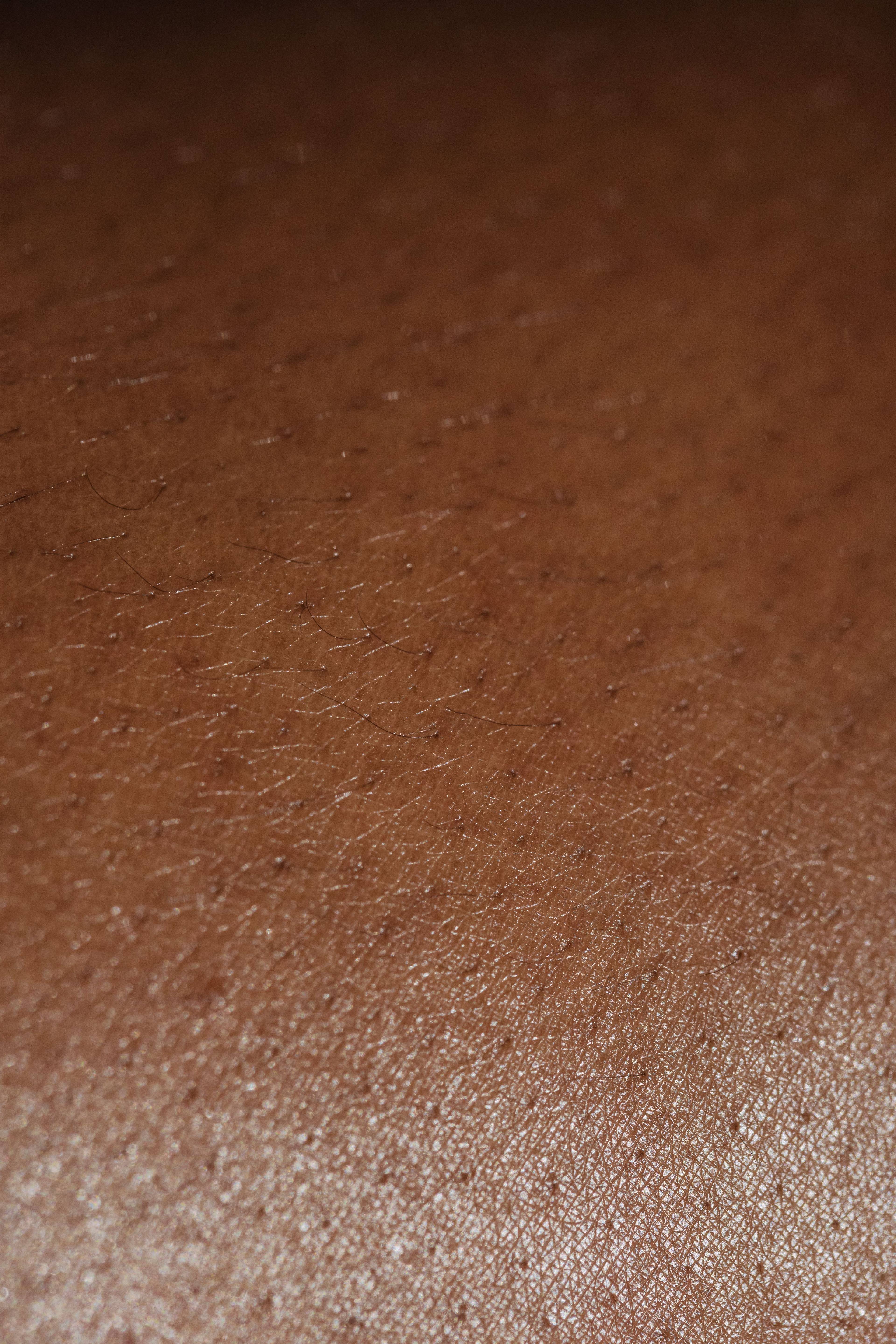 Formelskin Image