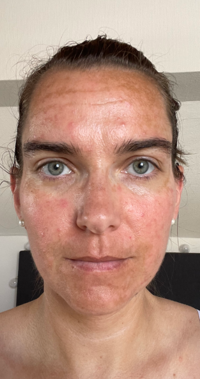 Formelskin Image