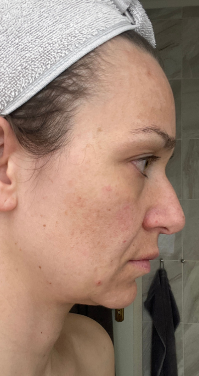 Formelskin Image