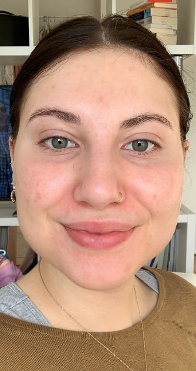 Formelskin Image