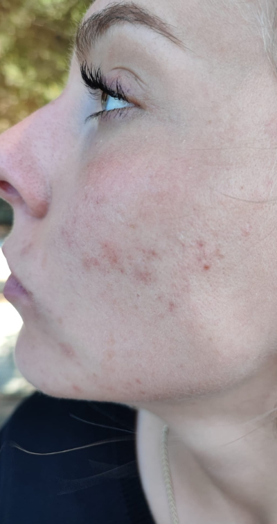 Formelskin Image