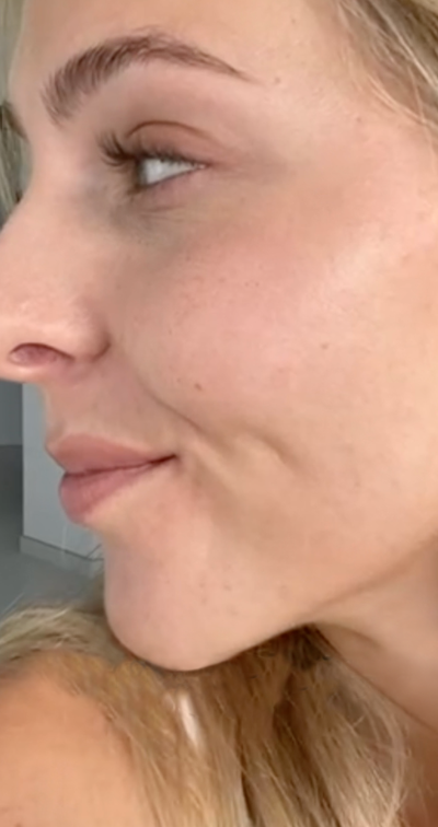 Formelskin Image
