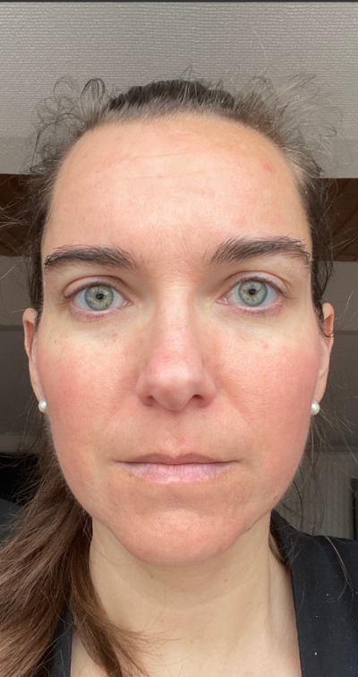 Formelskin Image