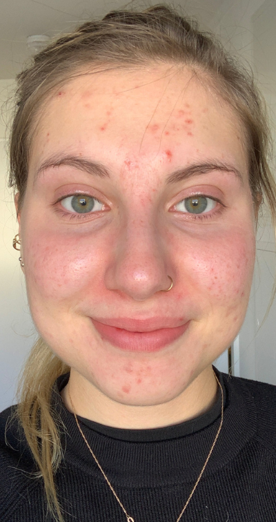 Formelskin Image