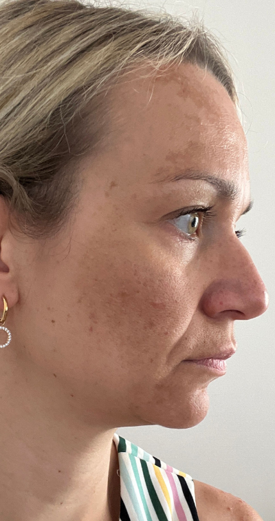 Formelskin Image