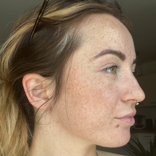 Formelskin Image