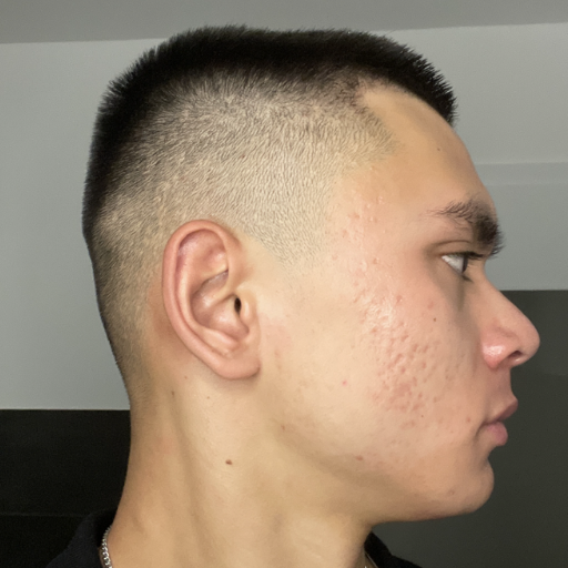 Formelskin Image