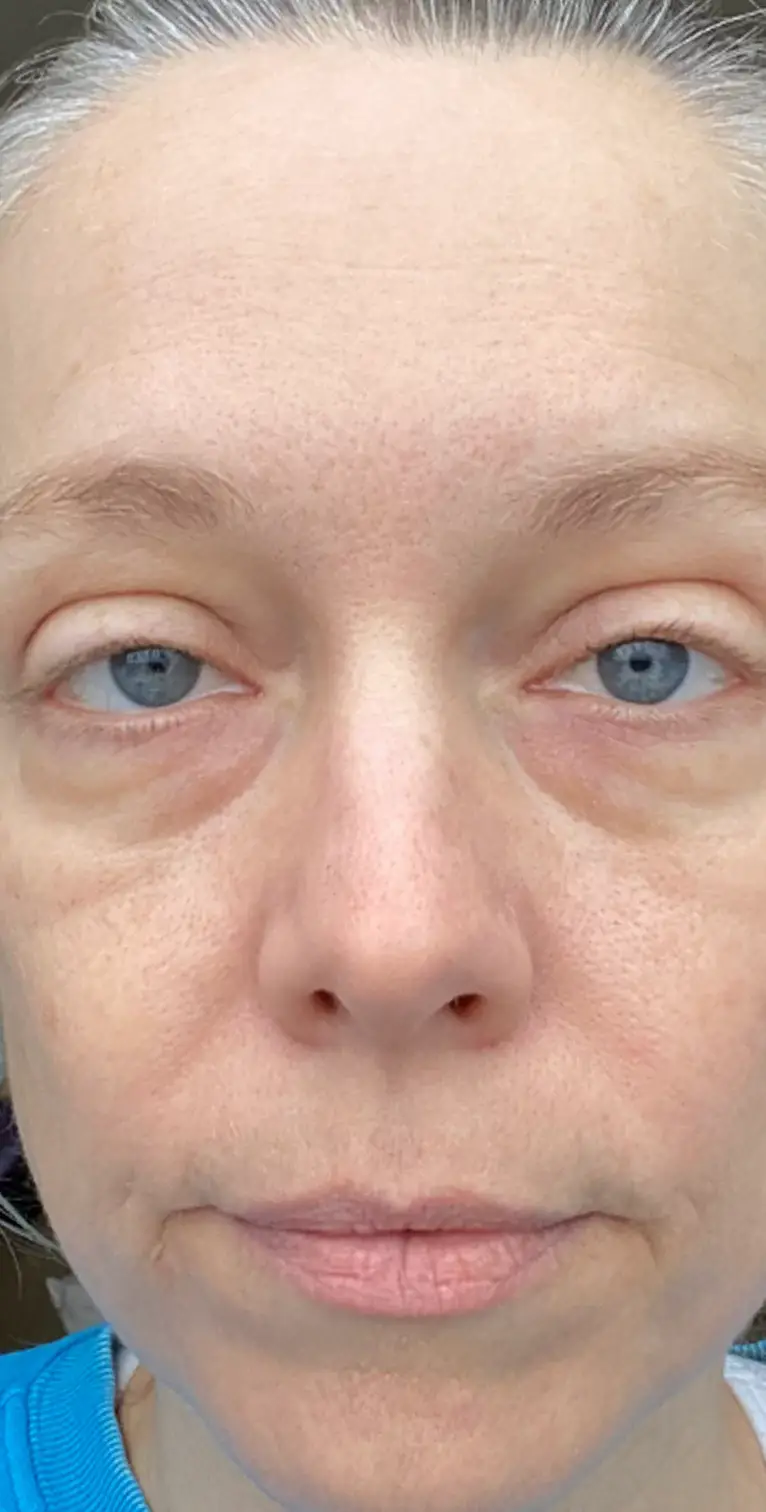 Formelskin Image