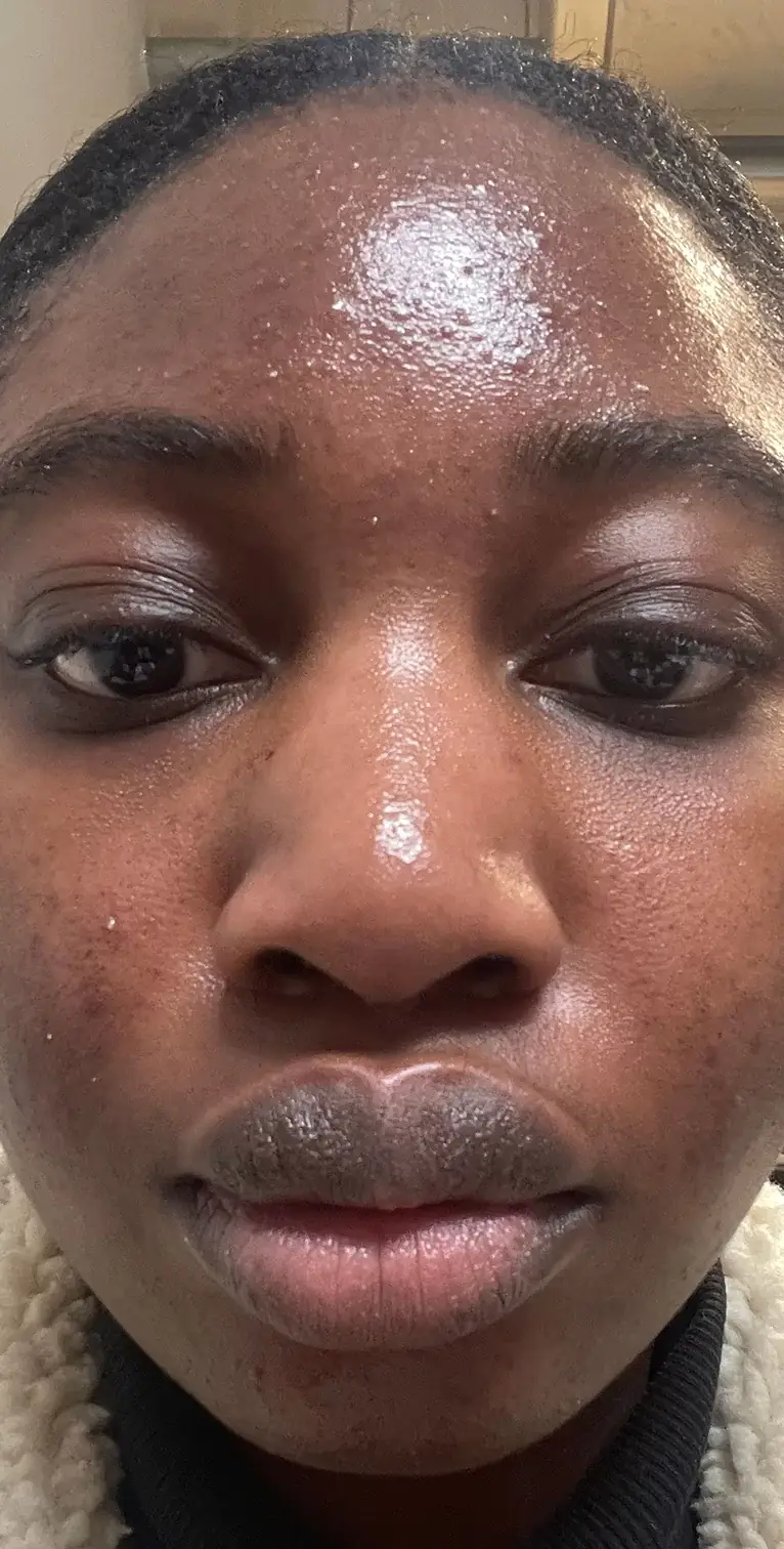 Formelskin Image