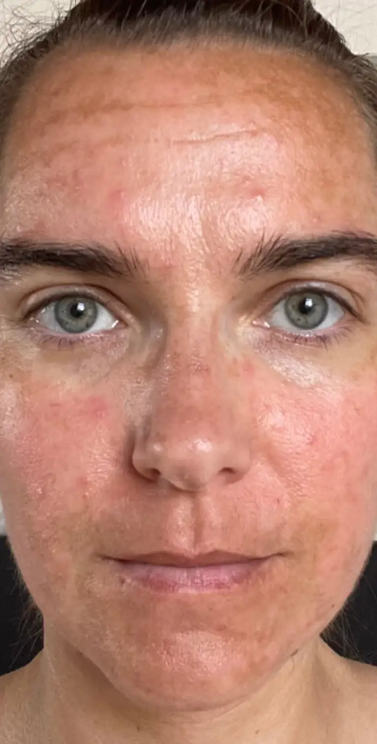 Formelskin Image