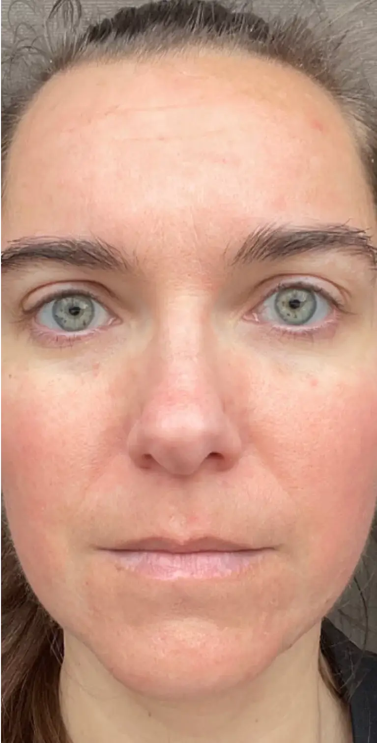 Formelskin Image