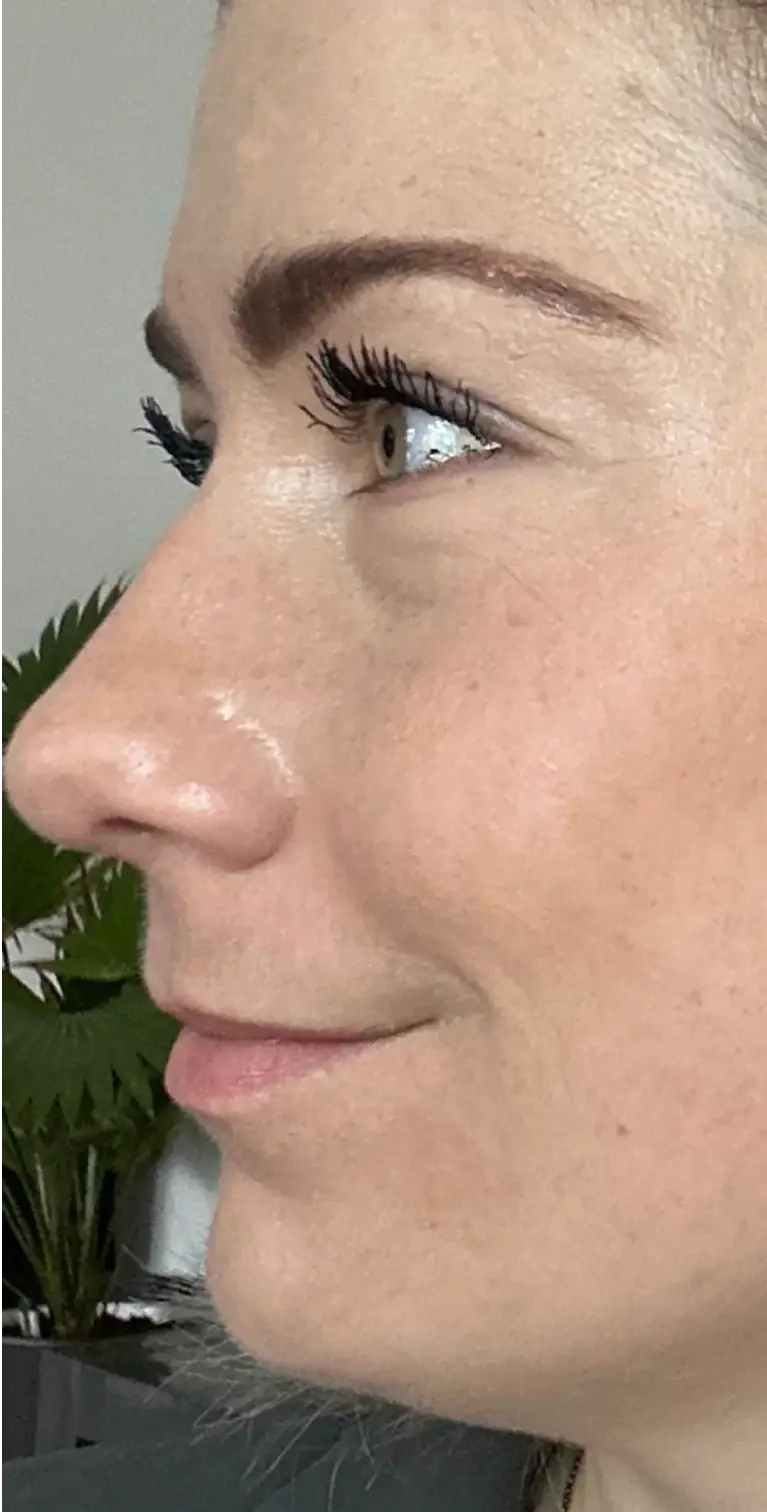 Formelskin Image
