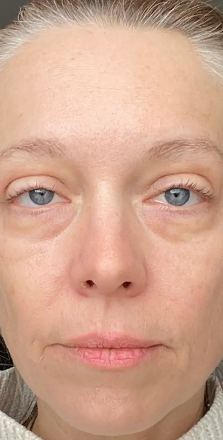 Formelskin Image